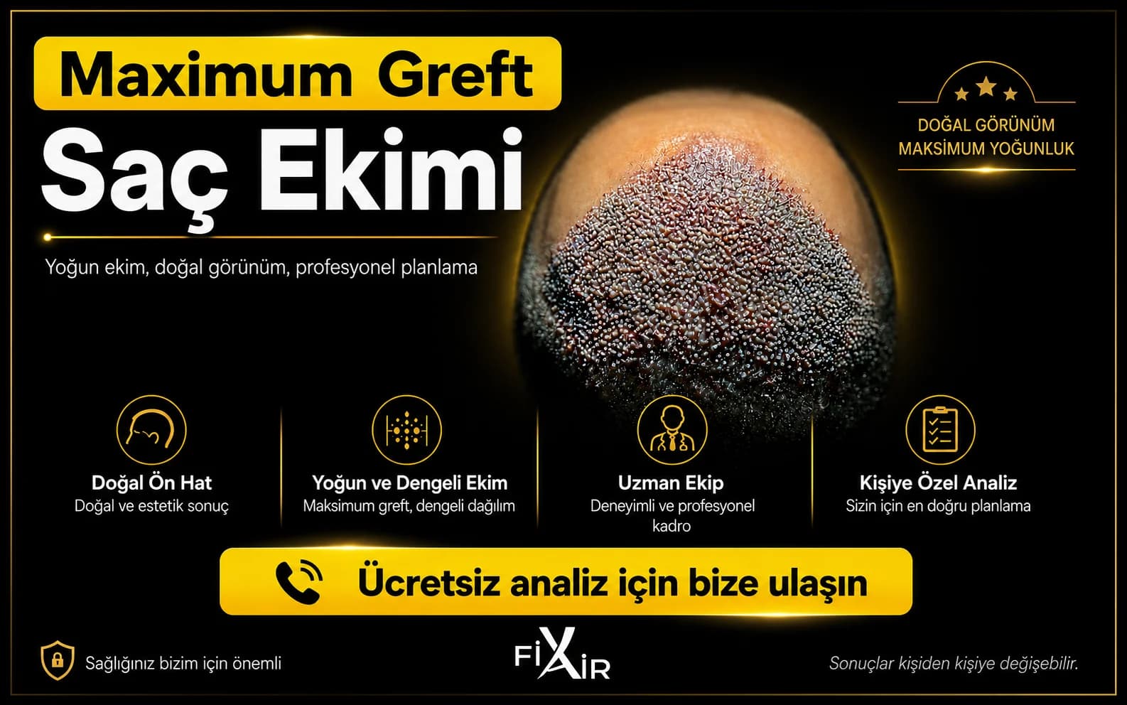 Safir FUE Saç Ekimi - Görsel 1